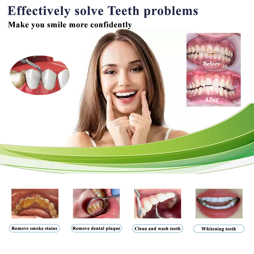 5 in 1 dental machine - Welcome to diente-dental.com! 5 in 1 dental machine